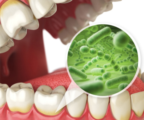 歯周病治療・歯周外科